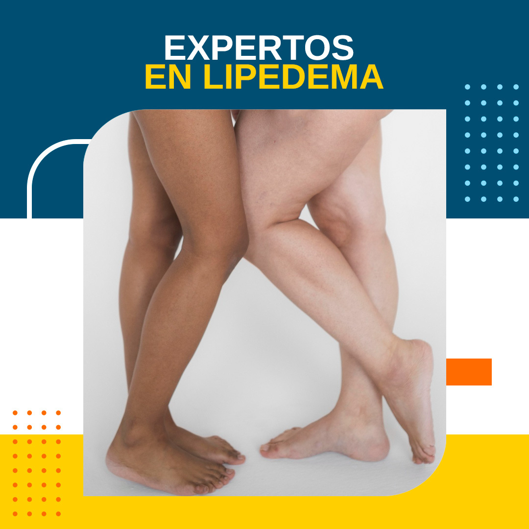EXPERTOS EN LIPEDEMA